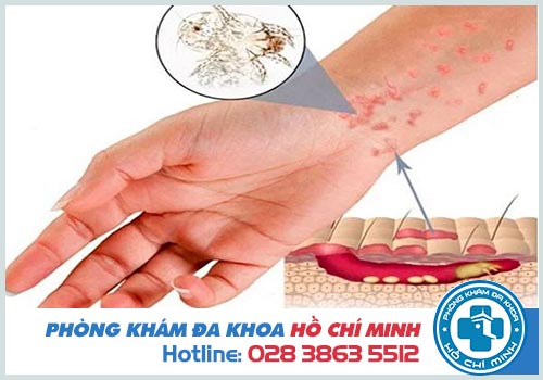 Top 24 Phòng khám bệnh trĩ Quận 9 kín đáo và có bác sĩ giỏi