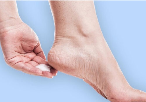 10 Cách trị nứt gót chân sau khi sinh