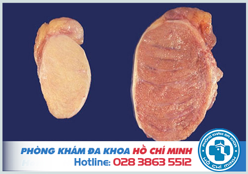 Bài thuốc chữa teo tinh hoàn tại nhà an toàn hiệu quả theo dân gian