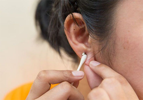 Bấm lỗ tai bị sưng cục ngứa phải làm sao?