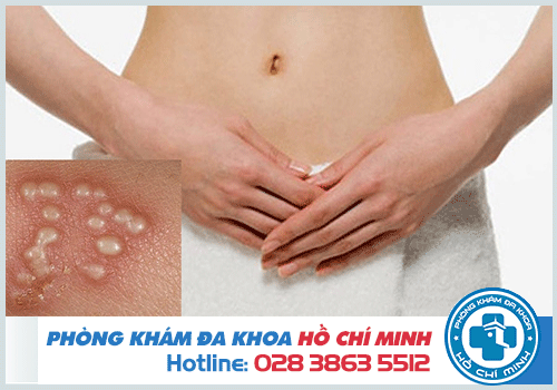 Bệnh mụn rộp sinh dục có tự khỏi được không