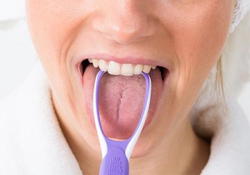 Bị rát lưỡi: nguyên nhân và cách điều trị hiệu quả
