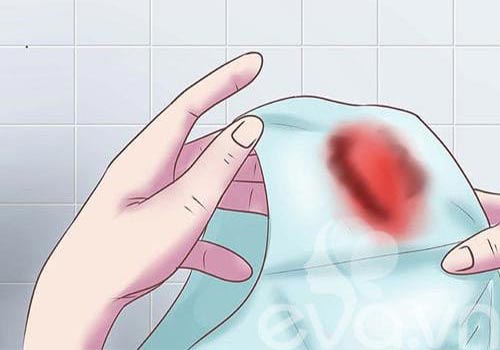 Cách xử trí chảy máu vùng kín tại nhà