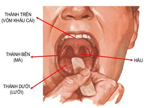Cấu tạo khoang miệng và Các bệnh về khoang miệng hay gặp