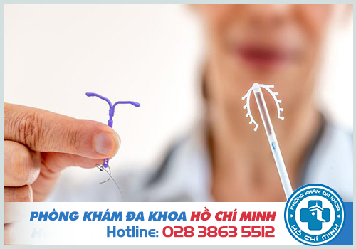 Chi phí đặt vòng tránh thai hết bao nhiêu tiền năm 2023