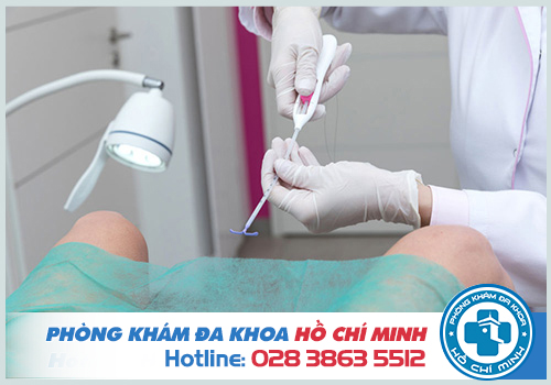 Chi phí đặt vòng tránh thai hết bao nhiêu tiền năm 2023