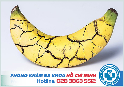 Chỉnh hình dương vật ở đâu và chi phí bao nhiêu tiền