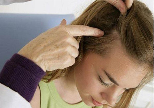 Da đầu nổi mụn: Nguyên nhân và 3 cách chữa trị