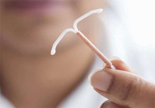 Đặt vòng tránh thai miễn phí ở đâu?