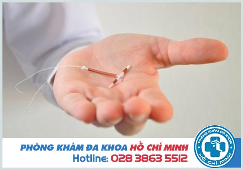 Dấu hiệu đặt vòng không hợp cần chú ý