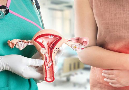 Hẹp cổ tử cung: Nguyên nhân, Dấu Hiệu và Cách điều trị