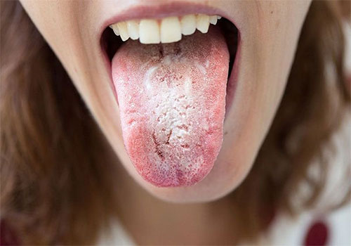Hình ảnh khoang miệng bình thường và các bệnh khoang miệng