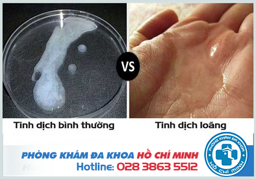 Hình ảnh tinh trùng bình thường ở nam giới Việt Nam