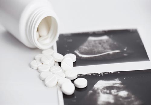 Hình ảnh viên thuốc phá thai và cách sử dụng