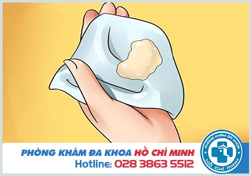 Huyết trắng đục sệt có Nguy Hiểm không?