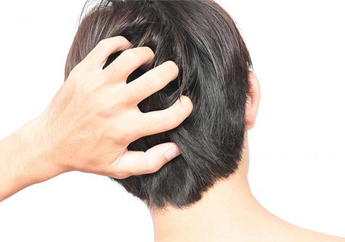 Mình thường xuyên bị ngứa da đầu có sao không?