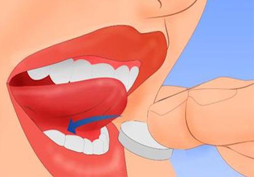 Ngậm thuốc phá thai dưới lưỡi có hiệu quả không?