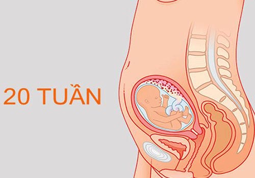 Phá thai 20 tuần tuổi có được không? Ở đâu và chi phí bao nhiêu?
