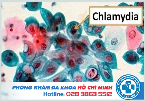 Phác đồ điều trị Chlamydia mãn tính hiệu quả nhất hiện nay