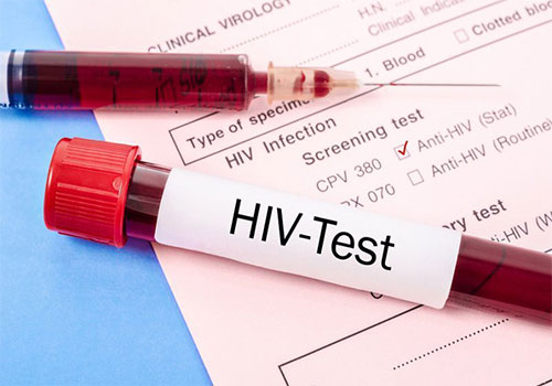 Test nhanh HIV sau 12 tuần có chính xác không?