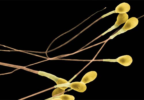 Tinh trùng màu vàng có thụ thai được không? Ảnh hưởng gì không?