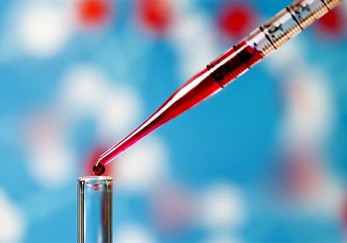Top 10 Địa chỉ xét nghiệm máu ở TPHCM uy tín nhất