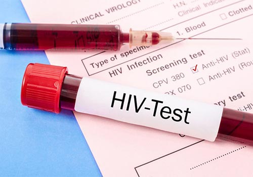 Xét nghiệm HIV mất bao lâu thì có kết quả?