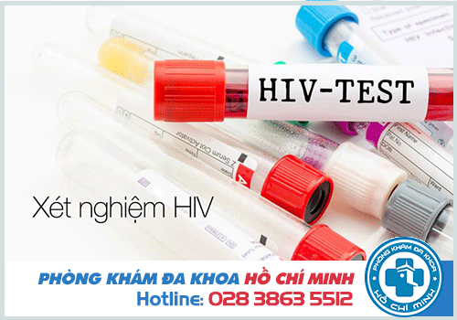 Xét nghiệm HIV ở đâu chính xác nhất và miễn phí