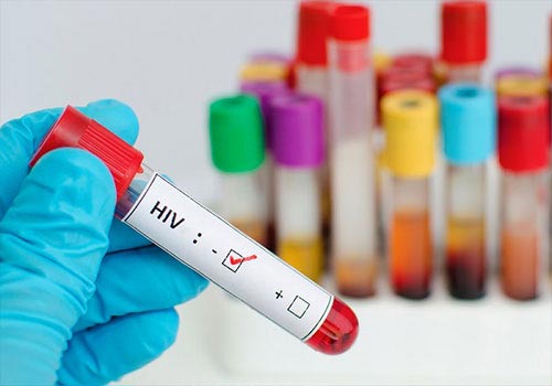 Xét nghiệm hiv ở Pasteur có chính xác không? Giá tiền?